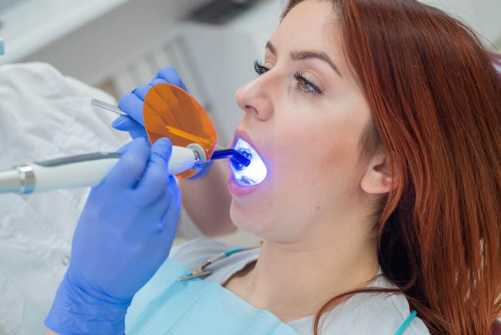 Dental Filling Port St Lucie
