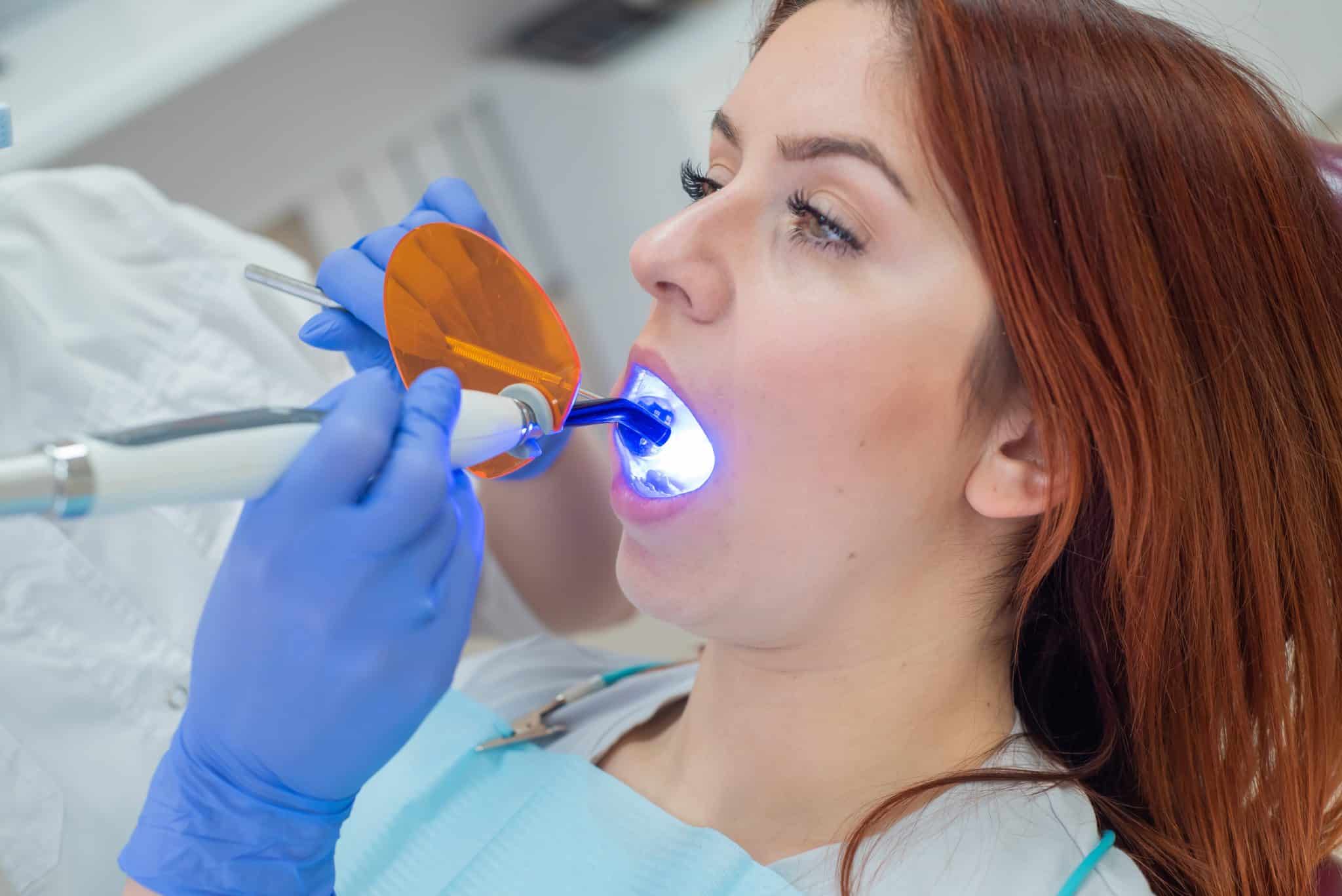 Gloved hands holding a blue curing light near a patient's teeth