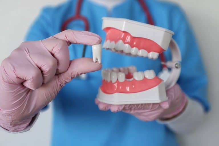 Dental Implant Restorations Port Saint Lucie FL